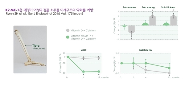 K2VITAL® MK-7 연구결과.