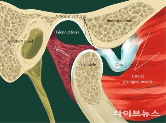 턱관절 통증과 정도가 심해지고, 가끔 디스크가 걸려 입이 안벌어지는 단계 (제공=연세굿데이치과)